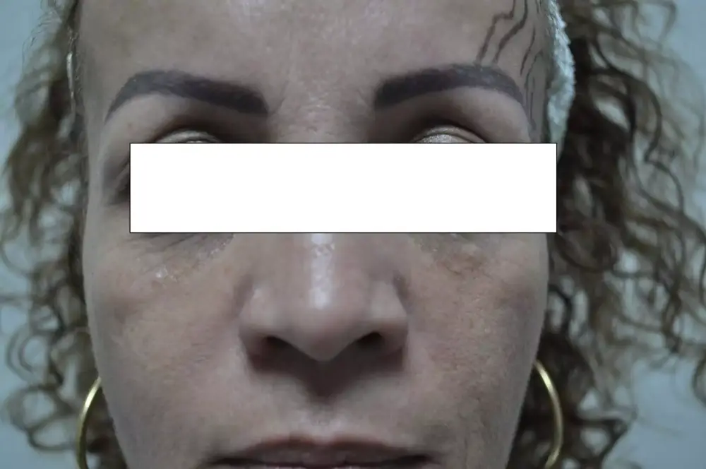 Face-Avant.jpg