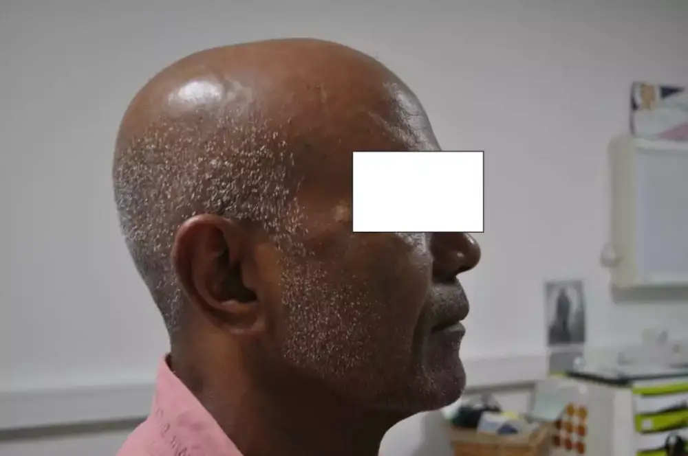 Profil-Avant-1