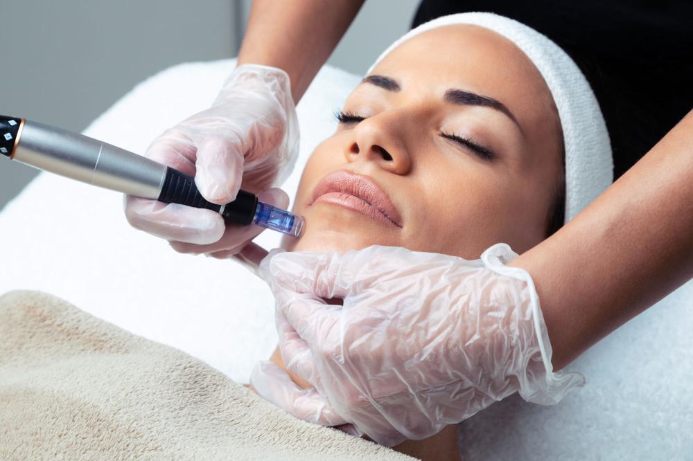 microdermabrasion