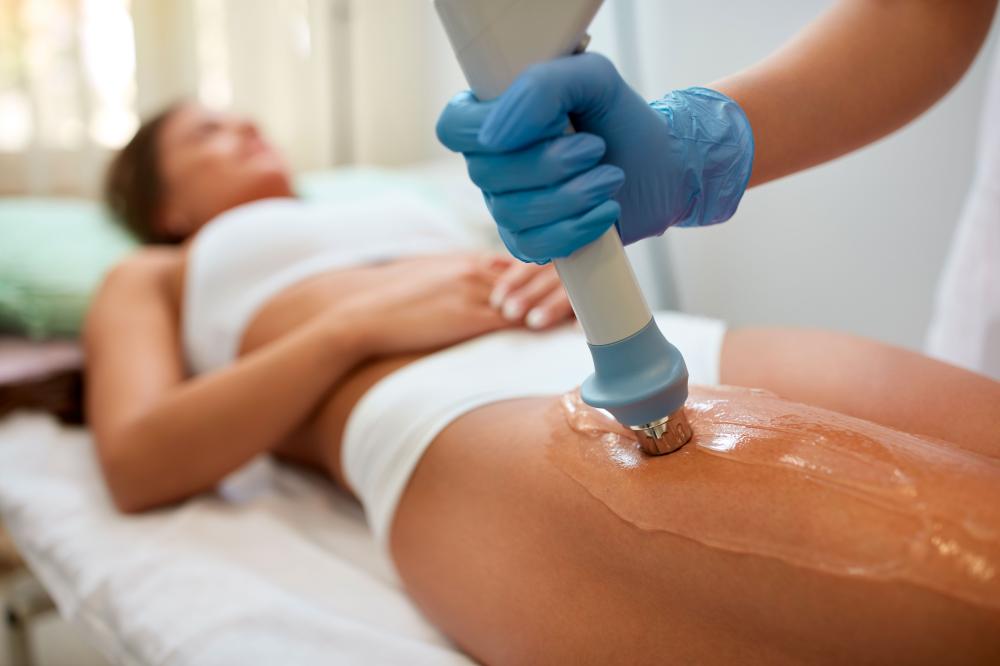 ondes-de-choc-cellulite