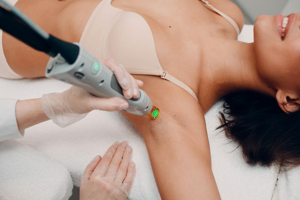 épilation laser à Sainte-Marie