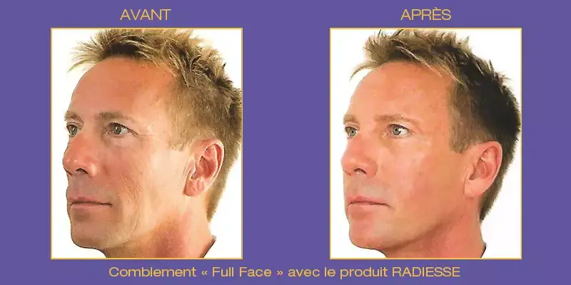 fullface2