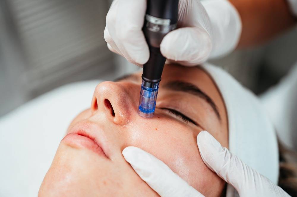 Centre laser medico esthetique - Aqua peel Tera (4)